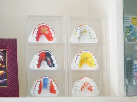 รีเทนเนอร์ราคาพิเศษ